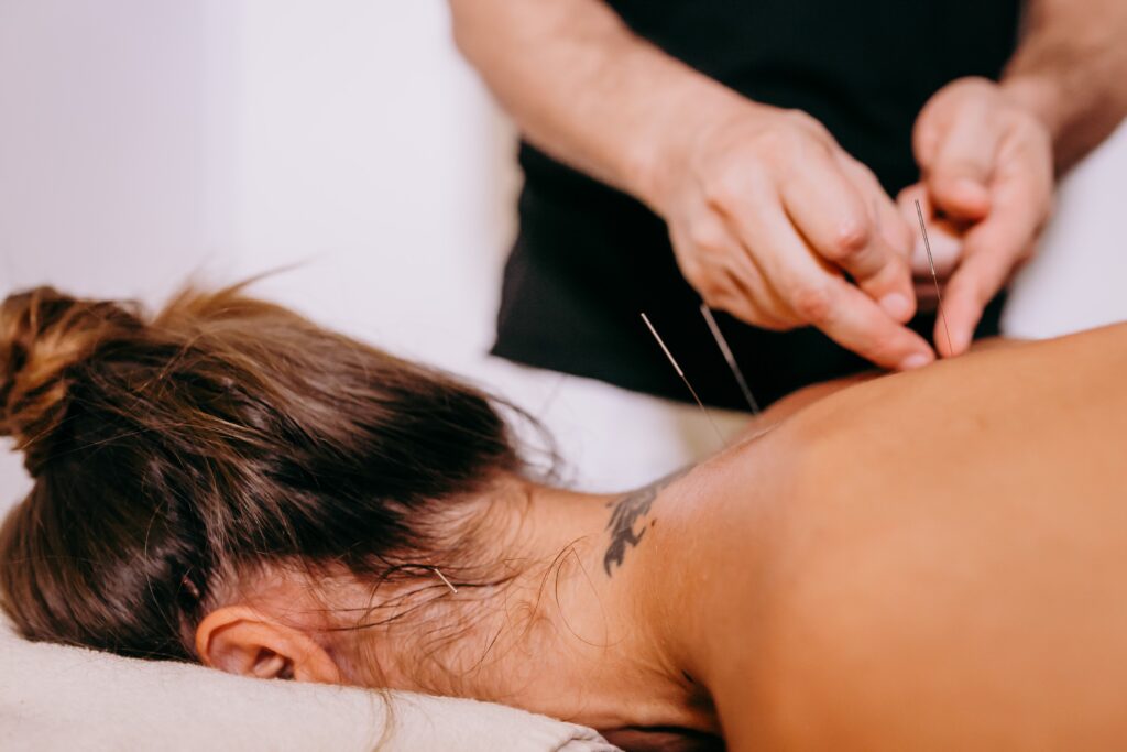Practitioner inserting a fine needle into a patient's upper back